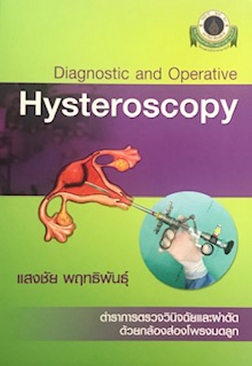 การตรวจวินิจฉัยและผ่าตัดด้วยกล้องส่องโพรงมดลูก (DIAGNOSTIC AND OPERATIVE HYSTEROSCOPY)