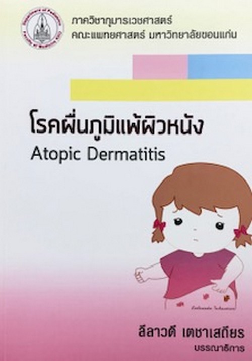 โรคผื่นภูมิแพ้ผิวหนัง (ATOPIC DERMATITIS)