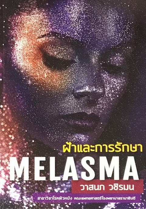 ฝ้าและการรักษา (MELASMA)