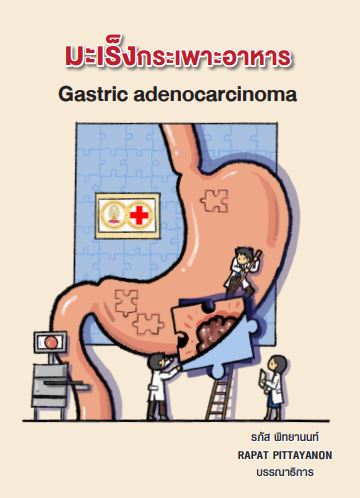 มะเร็งกระเพาะอาหาร (GASTRIC ADENOCARCINOMA)