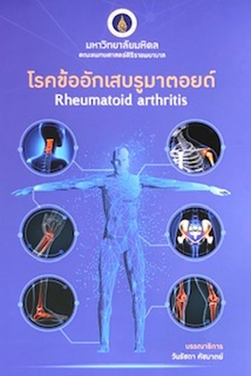 โรคข้ออักเสบรูมาตอยด์ (RHEUMATOID ARTHRITIS)