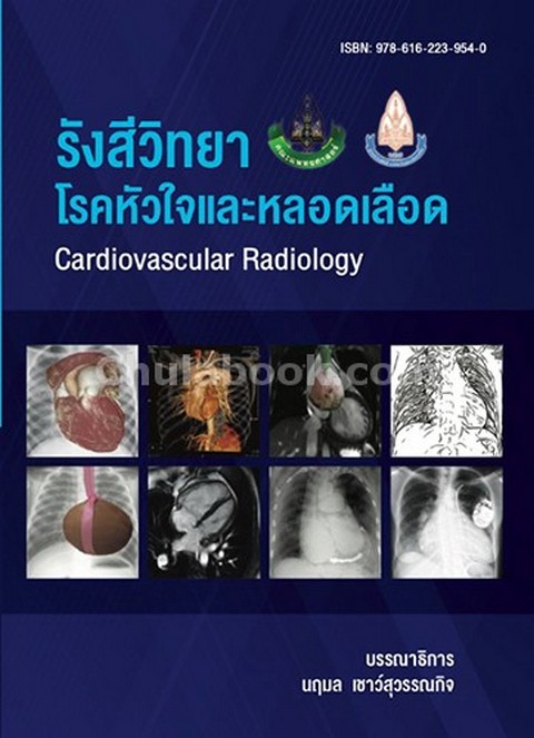 รังสีวิทยาโรคหัวใจและหลอดเลือด (CARDIOVASCULAR RADIOLOGY)