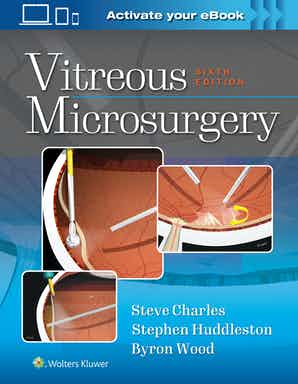 健康・医学 Vitreous Microsurgery VITREOUS MICROSURGERY (HC) | ศูนย์หนังสือจุฬาฯ