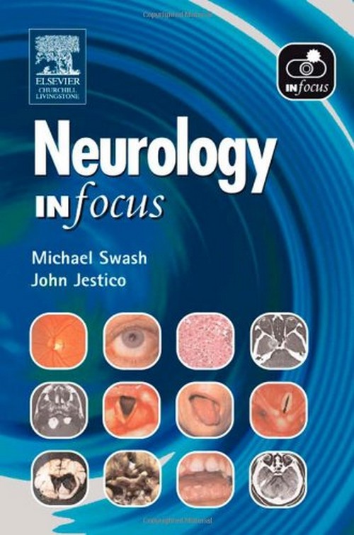 NEUROLOGY IN FOCUS