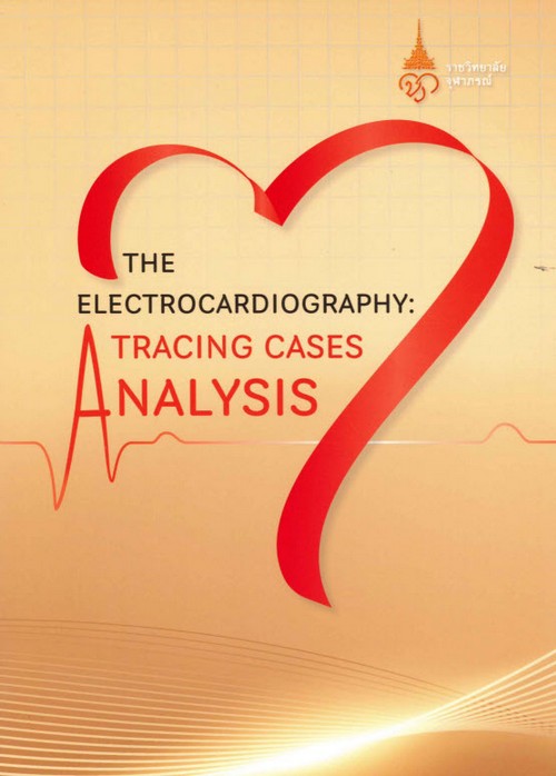 THE ELECTROCARDIOGRAPHY: TRACING CASES ANALYSIS