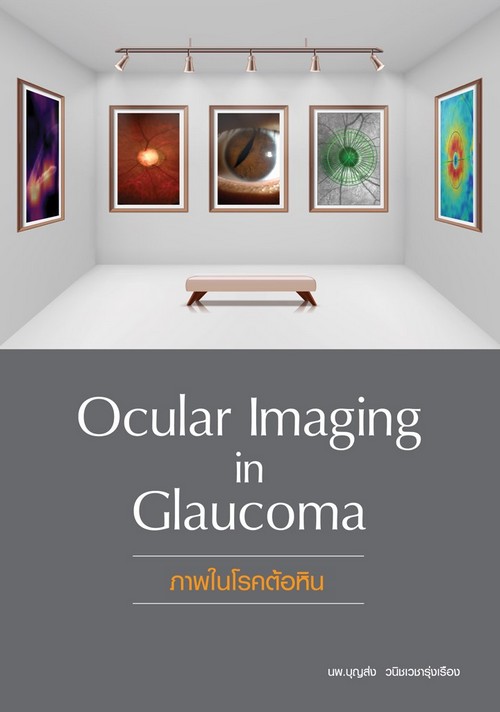 ภาพในโรคต้อหิน (OCULAR IMAGING IN GLAUCOMA)