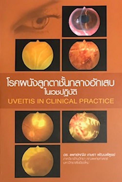 โรคผนังลูกตาชั้นกลางอักเสบในเวชปฏิบัติ (UVEITIS IN CLINICAL PRACTICE)