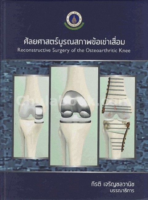 ศัลยศาสตร์บูรณสภาพข้อเข่าเสื่อม