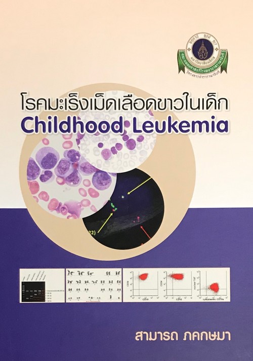 โรคมะเร็งเม็ดเลือดขาวในเด็ก (CHILDHOOD LEUKEMIA)