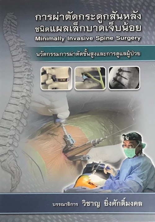 การผ่าตัดกระดูกสันหลังชนิดแผลเล็กบาดเจ็บน้อย (MINIMALLY INVASIVE SPINE SURGERY) นวัตกรรมการผ่าตัดขั้