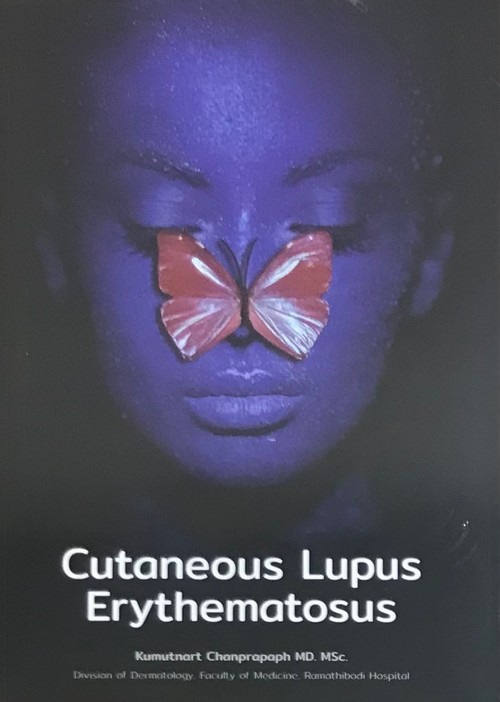 CUTANEOUS LUPUS ERYTHEMATOSUS