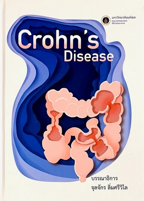 CROHN'S DISEASE