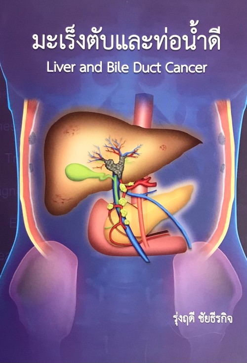 มะเร็งตับและท่อน้ำดี (LIVER AND BILE DUCT CANCER)