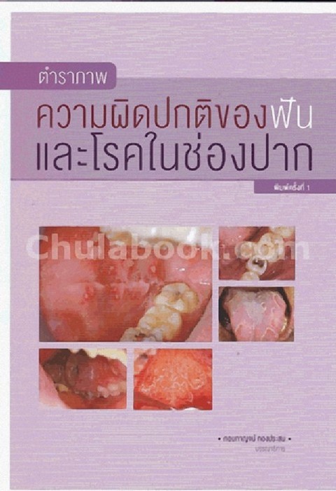 ตำราภาพความผิดปกติของฟันและโรคในช่องปาก