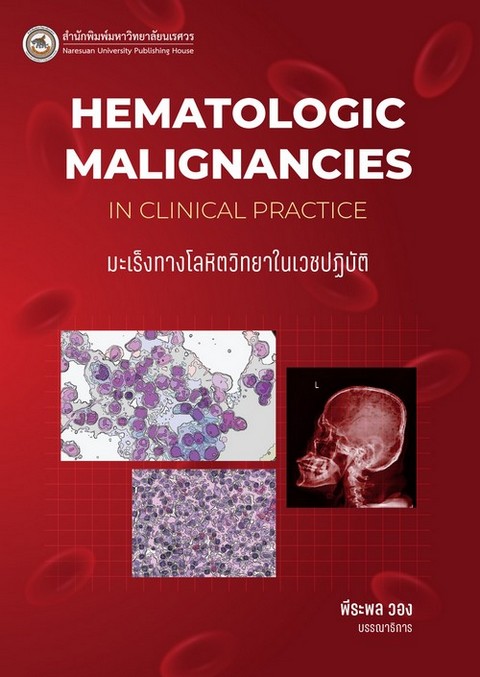 มะเร็งทางโลหิตวิทยาในเวชปฏิบัติ (HEMATOLOGIC MALIGNANCIES IN CLINICAL PRACTICE)