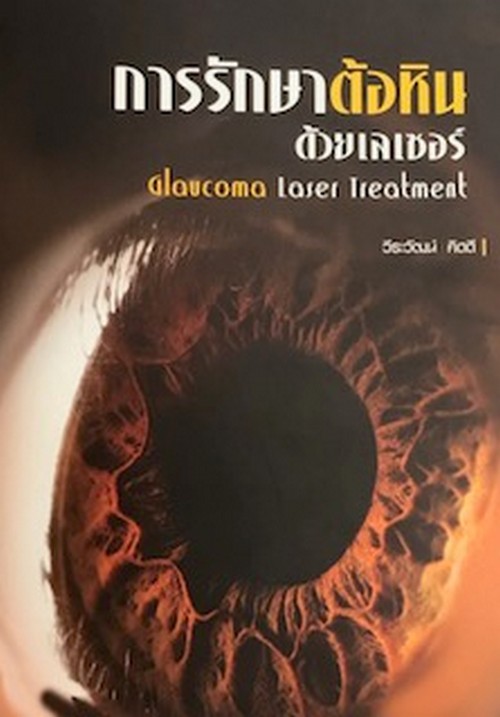 การรักษาต้อหินด้วยเลเซอร์ (GLAUCOMA LASER TREATMENT)