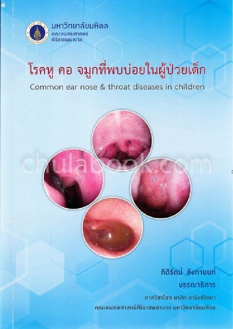 โรคหู คอ จมูกที่พบบ่อยในผู้ป่วยเด็ก (COMMON EAR NOSE & THROAT DISEASES IN CHILDREN) (ปกอ่อน)