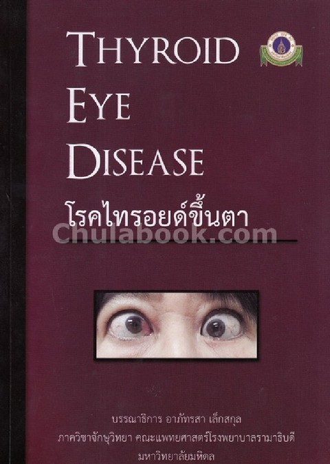 โรคไทรอยด์ขึ้นตา (THYROID EYE DISEASE)