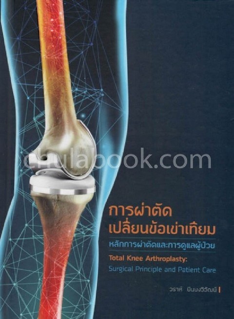 การผ่าตัดเปลี่ยนข้อเข่าเทียมหลักการผ่าตัดและการดูแลผู้ป่วย