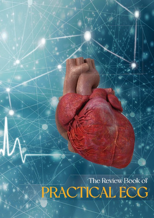 THE REVIEW BOOK OF PRACTICAL ECG