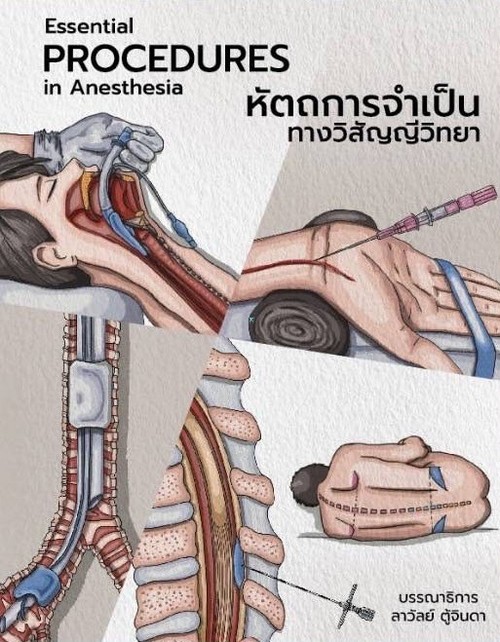 หัตถการจำเป็นทางวิสัญญีวิทยา (ESSENTIAL PROCEDURES IN ANESTHESIA)