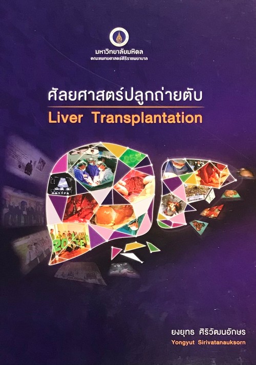 ศัลยศาสตร์ปลูกถ่ายตับ (LIVER TRANSPLANTATION)