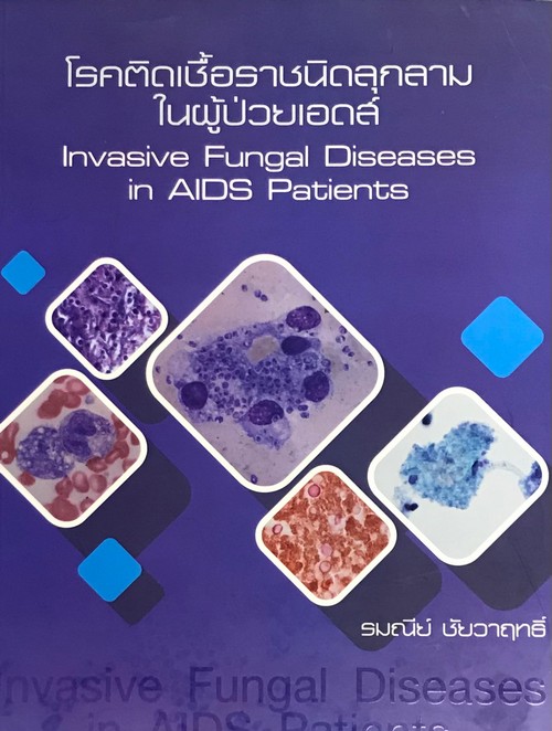 โรคติดเชื้อราชนิดลุกลามในผู้ป่วยเอดส์ (INVASIVE FUNGAL DISEASES IN AIDS PATIENTS)