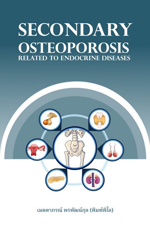 โรคกระดูกพรุนชนิดทุติยภูมิที่มีสาเหตุเกี่ยวเนื่องกับโรคในระบบต่อมไร้ท่อ (SECONDARY OSTEOPOROSIS RELA
