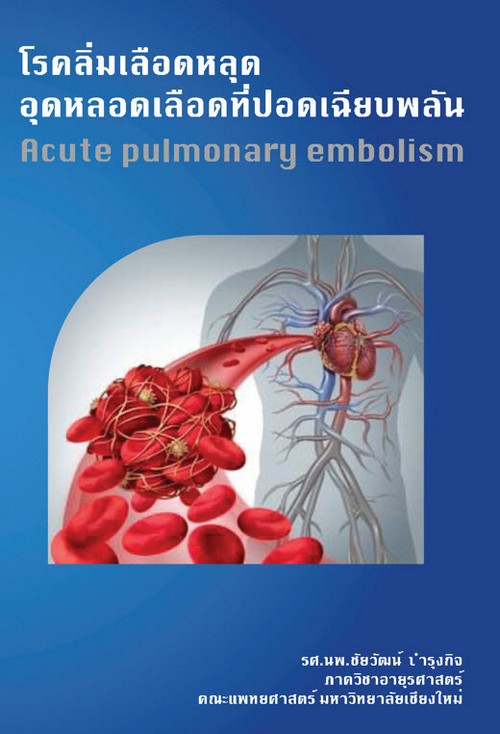 โรคลิ่มเลือดหลุดอุดหลอดเลือดที่ปอดเฉียบพลัน (ACUTE PULMONARY EMBOLISM)