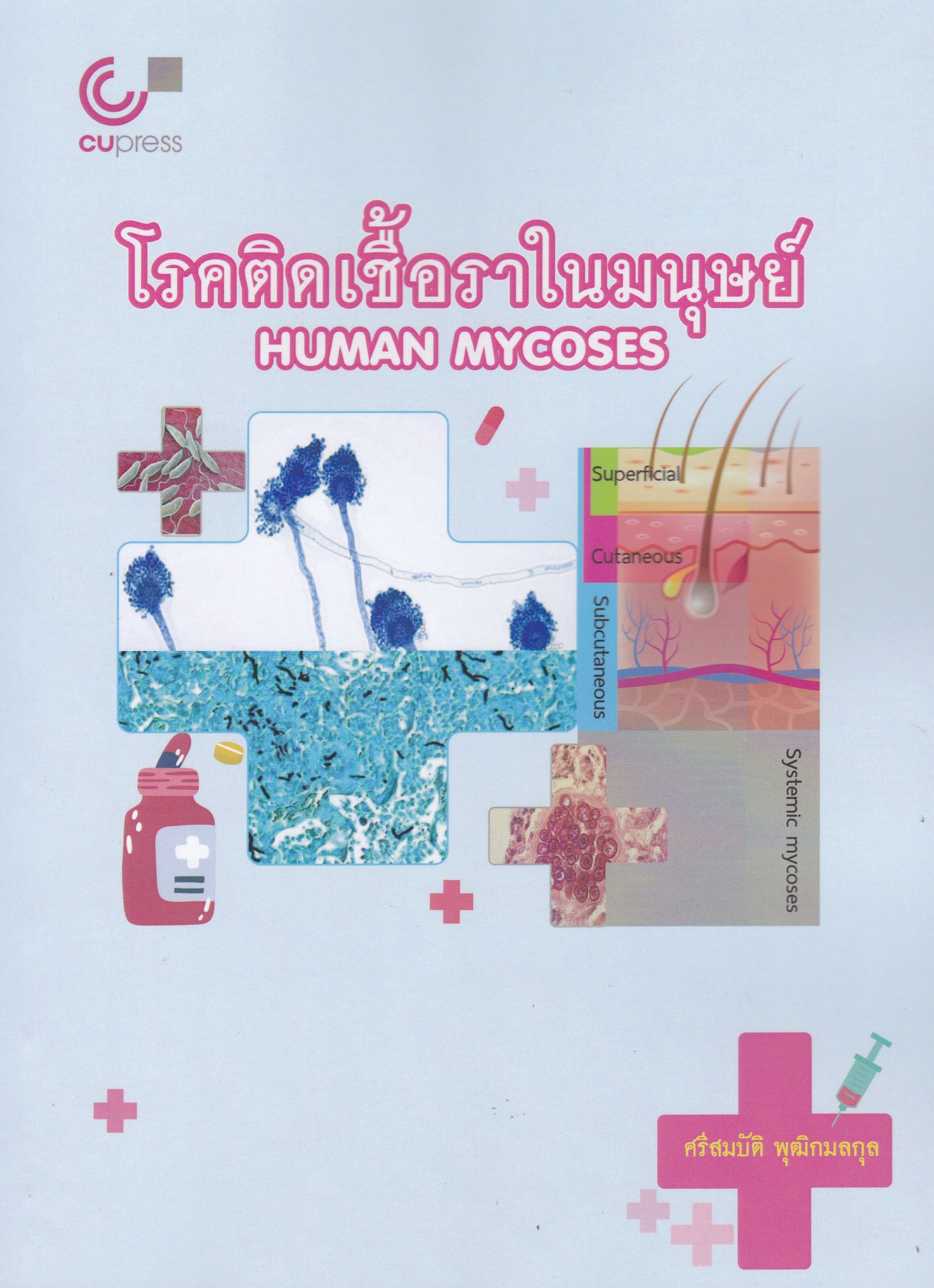 โรคติดเชื้อราในมนุษย์ (HUMAN MYCOSES)