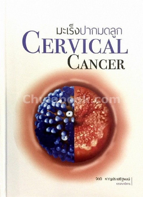มะเร็งปากมดลูก (CERVICAL CANCER)