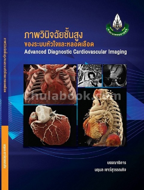 ภาพวินิจฉัยชั้นสูงของระบบหัวใจและหลอดเลือด (ADVANCED DIAGNOSTIC CARDIOVASCULAR IMAGING)