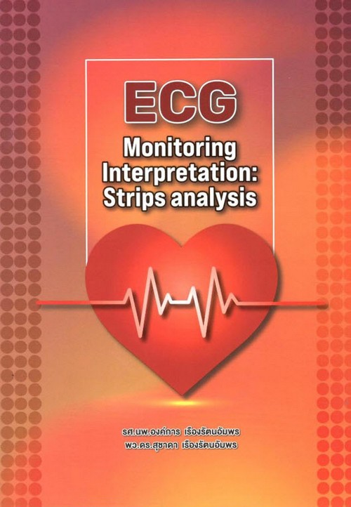 ECG MONITORING INTERPRETATION: STRIPS ANALYSIS