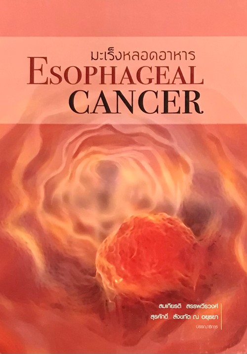มะเร็งหลอดอาหาร (ESOPHAGEAL CANCER)