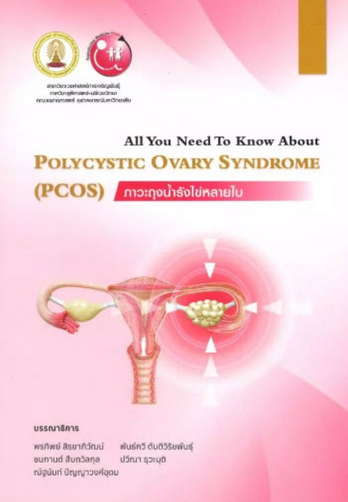 ภาวะถุงน้ำรังไข่หลายใบ (POLYCYSTIC OVARY SYNDROME (PCOS))
