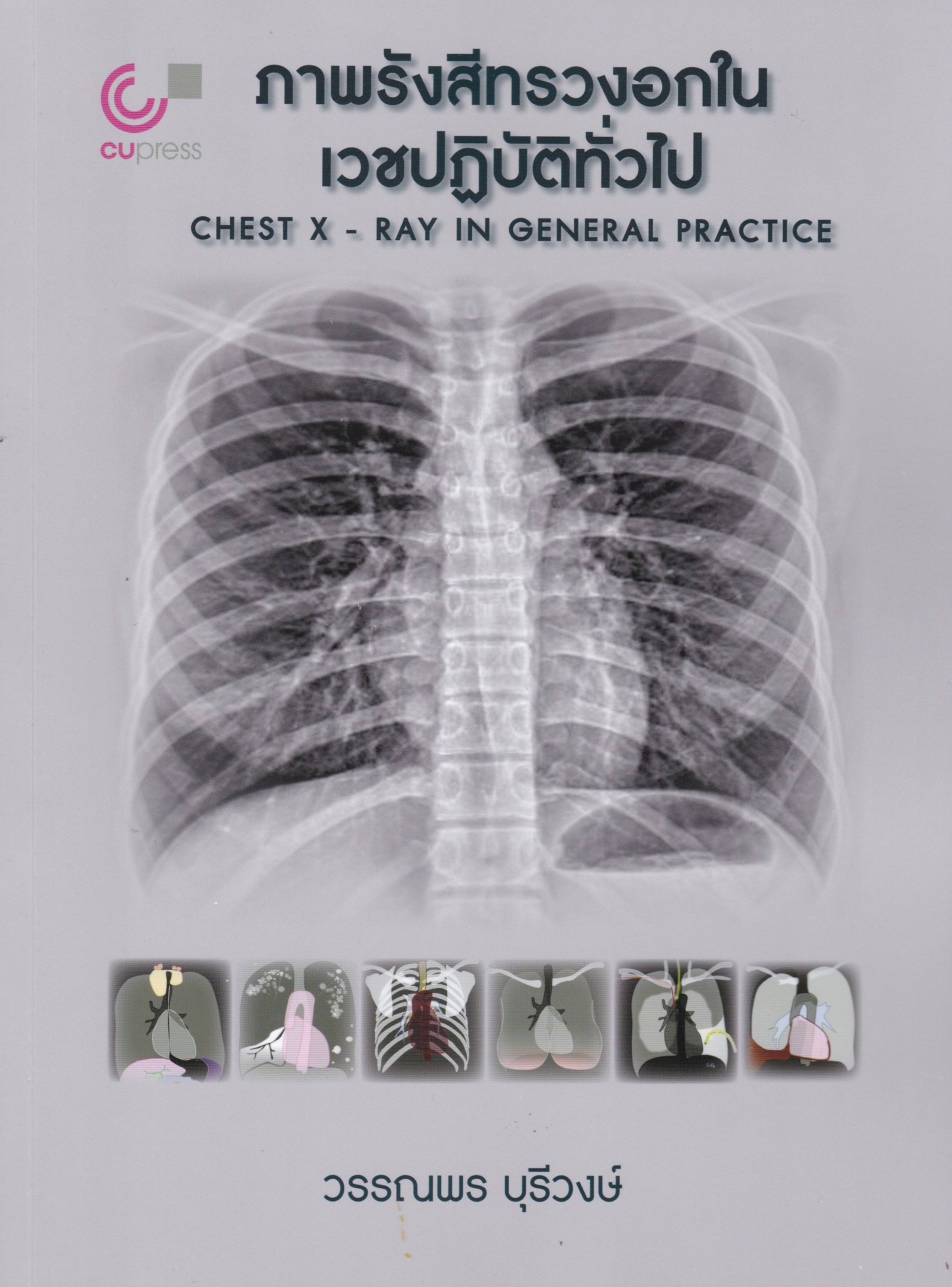 ภาพรังสีทรวงอกในเวชปฏิบัติทั่วไป (CHEST X-RAY IN GENERAL PRACTICE)