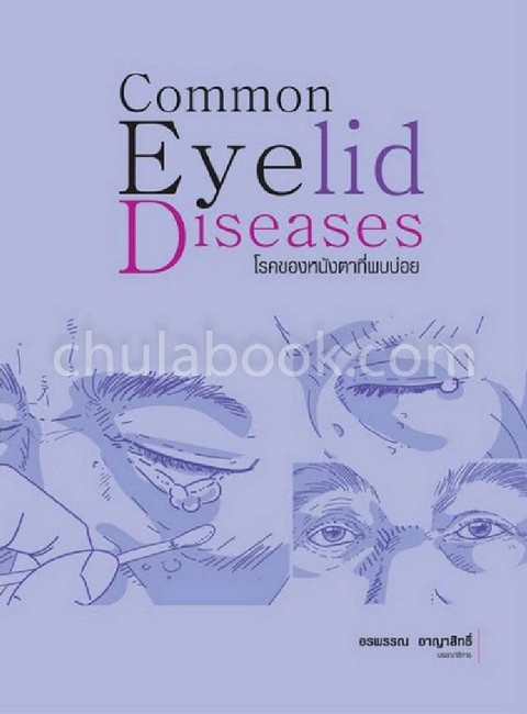 โรคของหนังตาที่พบบ่อย (COMMON EYELID DISEASES)