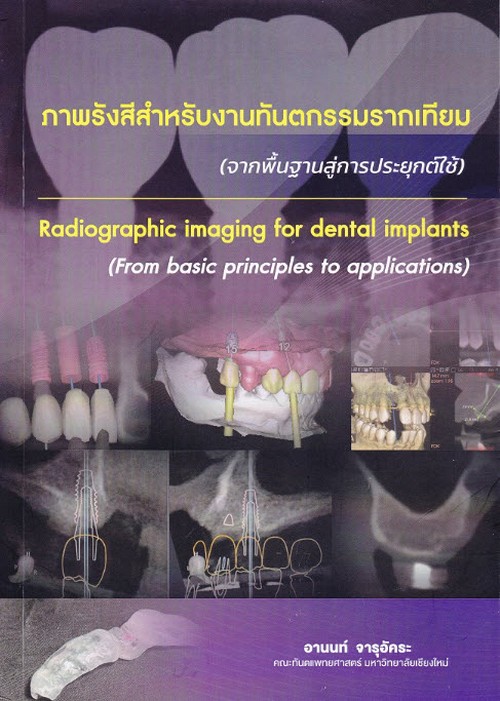 ภาพรังสีสำหรับงานทันตกรรมรากเทียม (จากพื้นฐานสู่การประยุกต์ใช้)