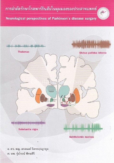 การผ่าตัดรักษาโรคพาร์กินสันในมุมมองของประสาทแพทย์ (NEUROLOGICAL PERSPECTIVES OF PARKINSON'S DISEASE