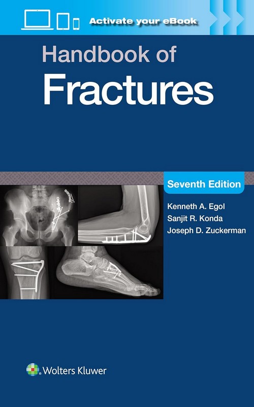 HANDBOOK OF FRACTURES (PRINT + EBOOK WITH MULTIMEDIA)