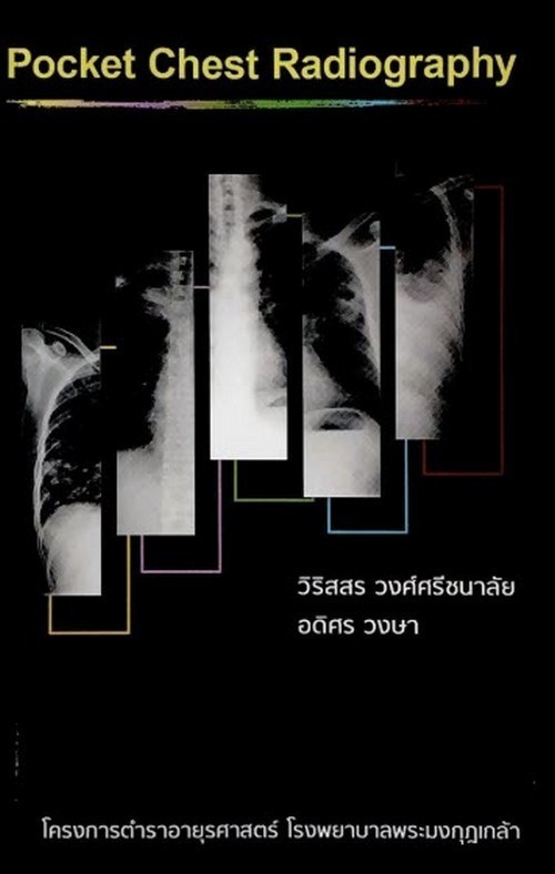 POCKET CHEST RADIOGRAPHY