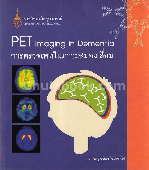การตรวจเพทในภาวะสมองเสื่อม (PET IMAGING IN DEMENTIA)
