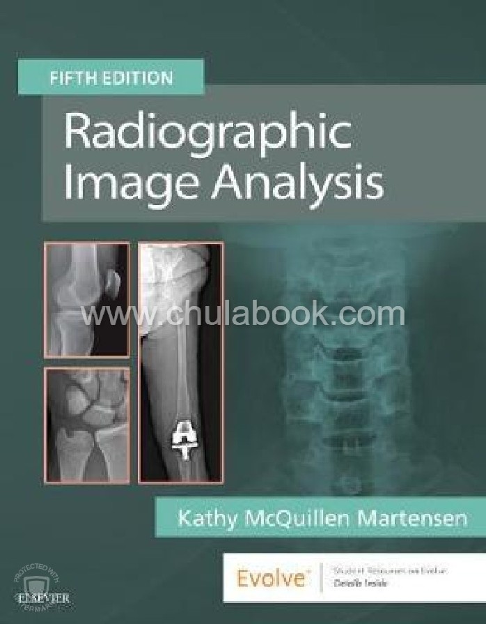 RADIOGRAPHIC IMAGE ANALYSIS (HC)