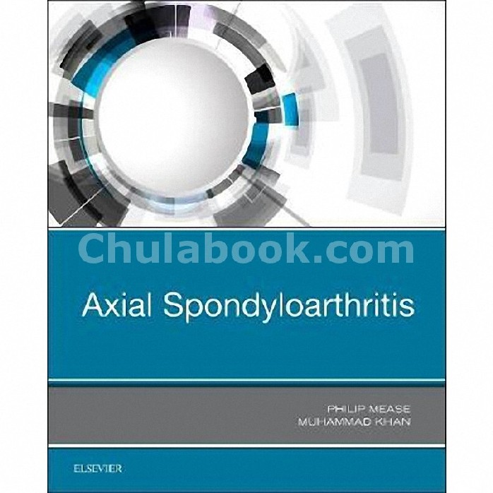 AXIAL SPONDYLOARTHRITIS