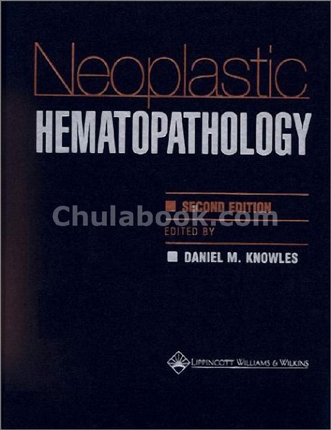 NEOPLASTIC HEMATOPATHOLOGY
