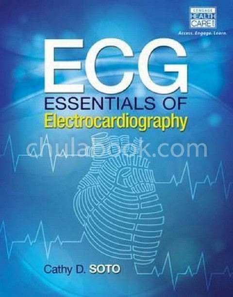 ECG: ESSENTIALS OF ELECTROCARDIOGRAPHY