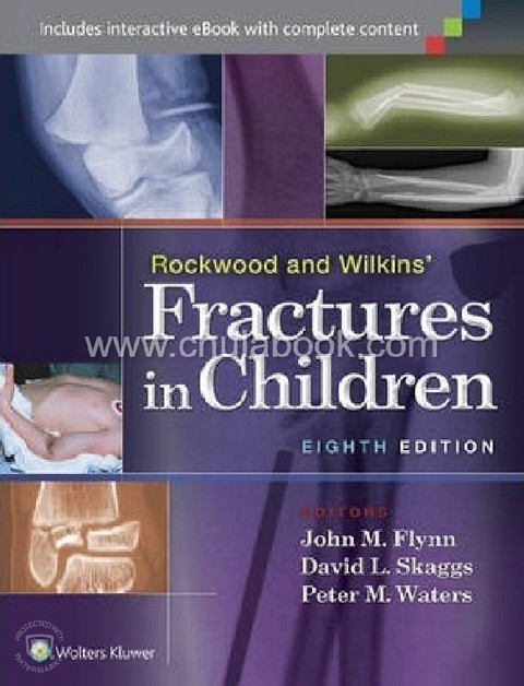 ROCKWOOD AND WILKINS' FRACTURES IN CHILDREN (HC)