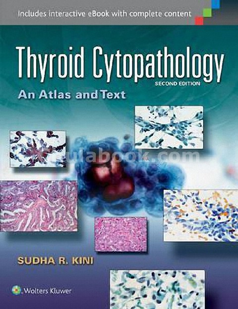 THYROID CYTOPATHOLOGY: AN ATLAS AND TEXT