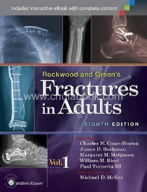 ROCKWOOD & GREEN'S FRACTURES IN ADULTS (VOLUME 1-2)