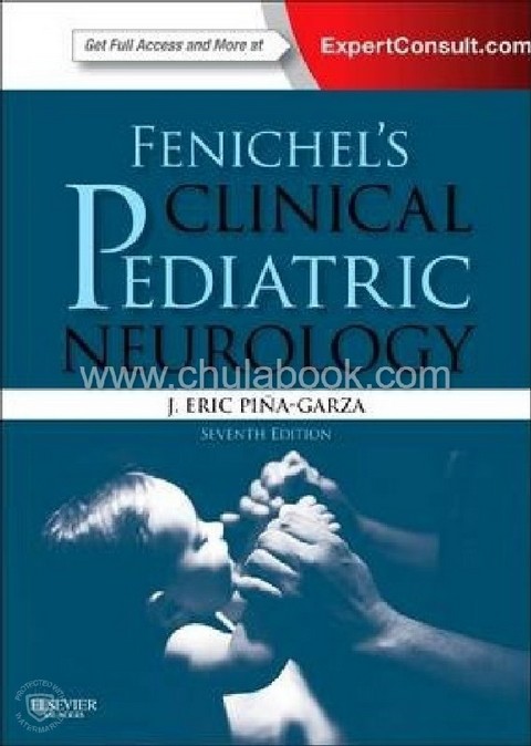 CLINICAL PEDIATRIC NEUROLOGY: A SIGNS AND SYMPTOMS APPROACH